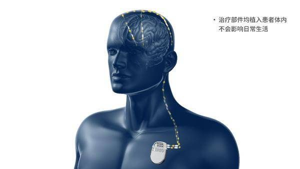 d8be714971f316eed6b9b748e70c2251