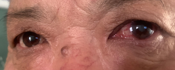 f9e652fc083e71610277e7228cf54de5