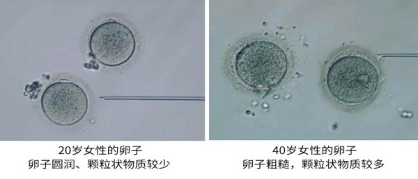 202604161449415859 202604161449415859