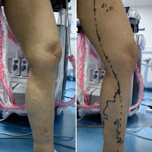 69d9bf4c78fbf 69d9bf4c78fbf