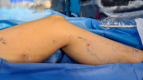 69d9bf4cb6343 69d9bf4cb6343