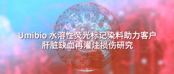 2b016afdfff63b81d15de3d71c149f932100405a_sm