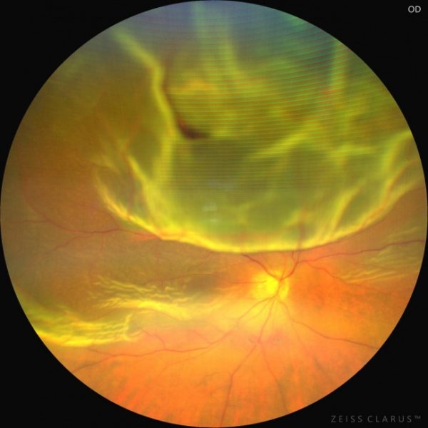 image1_sm-102